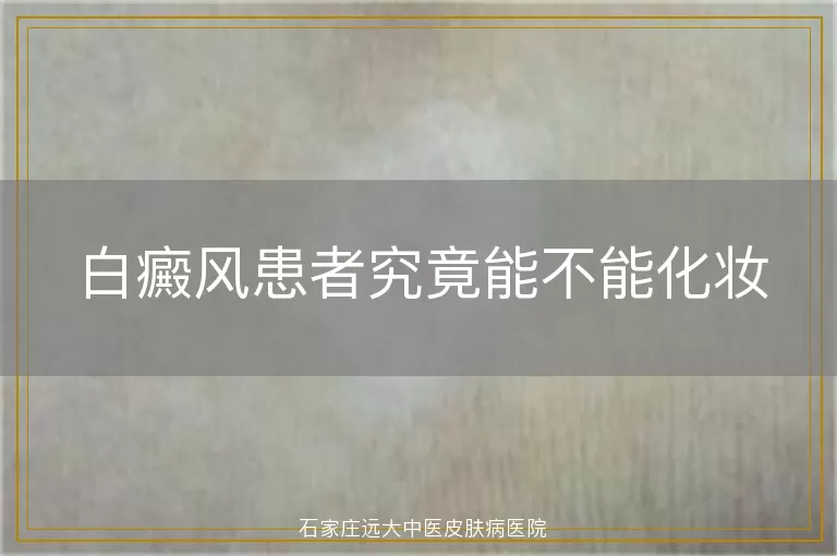 白癜风患者究竟能不能化妆