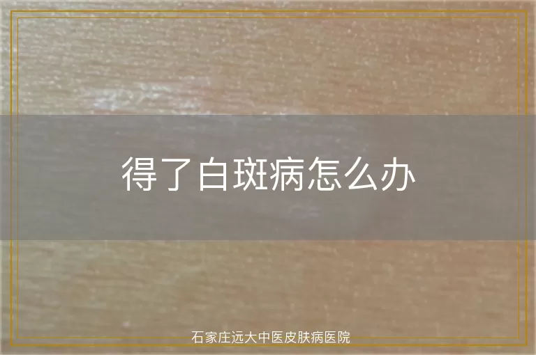得了白斑病怎么办