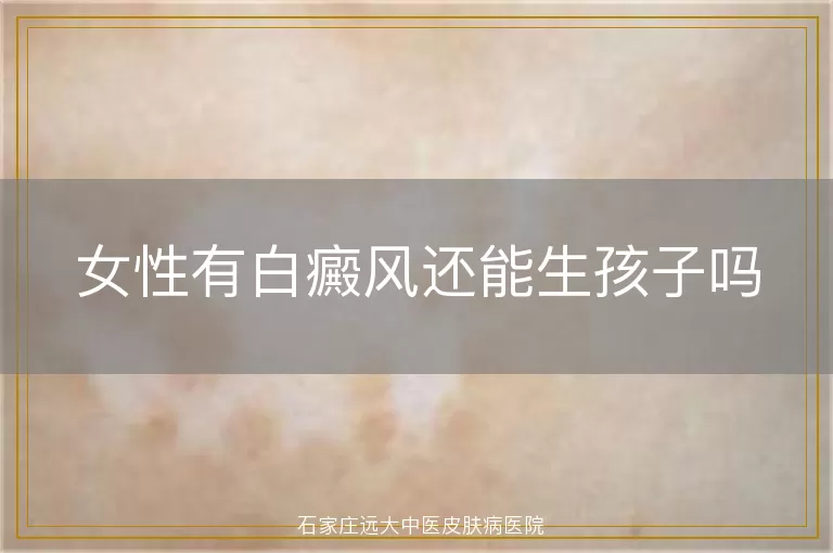 女性有白癜风还能生孩子吗