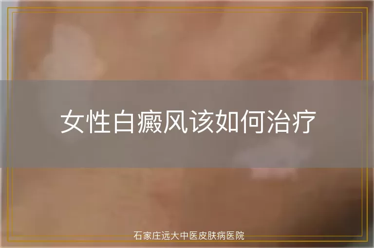 女性白癜风该如何治疗
