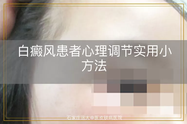 白癜风患者心理调节实用小方法