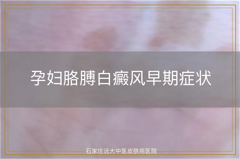 孕妇胳膊白癜风早期症状