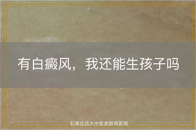 有白癜风，我还能生孩子吗
