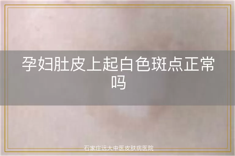 孕妇肚皮上起白色斑点正常吗