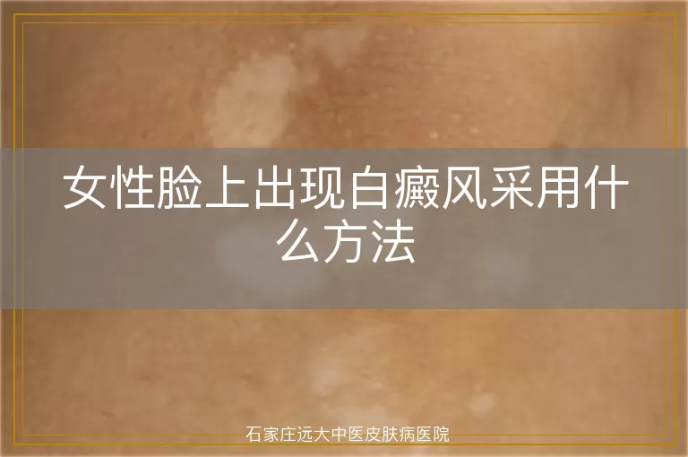 女性脸上出现白癜风采用什么方法