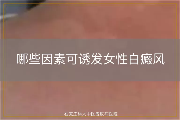 哪些因素可诱发女性白癜风