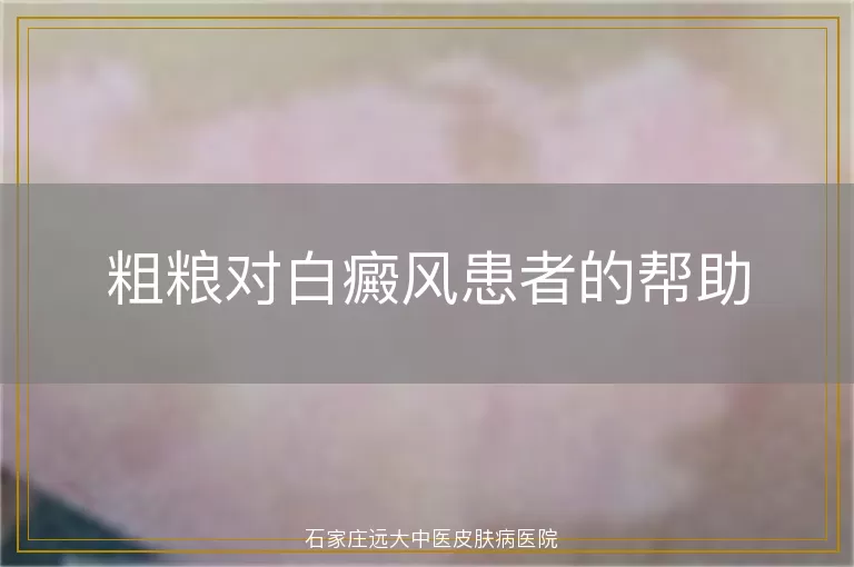 粗粮对白癜风患者的帮助