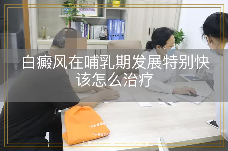白癜风在哺乳期发展特别快该怎么治疗