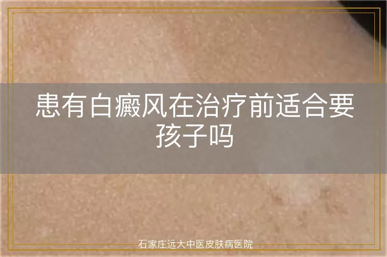 患有白癜风在治疗前适合要孩子吗