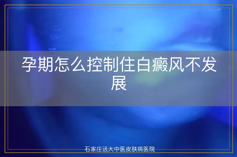 孕期怎么控制住白癜风不发展