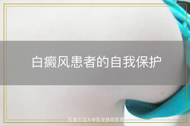 白癜风患者的自我保护