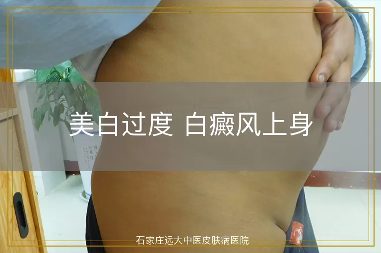 免疫失衡