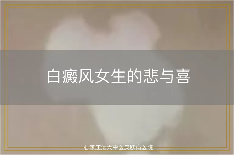 白癜风女生的悲与喜