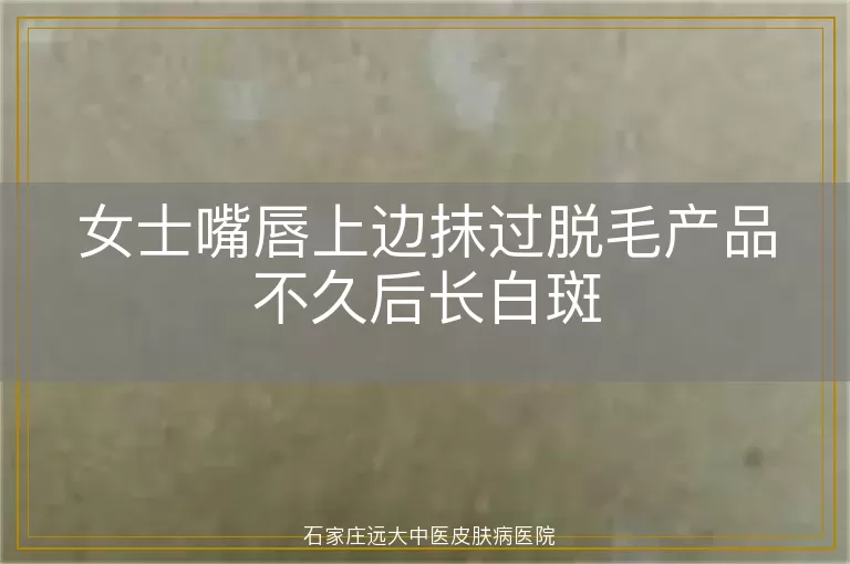女士嘴唇上边抹过脱毛产品不久后长白斑