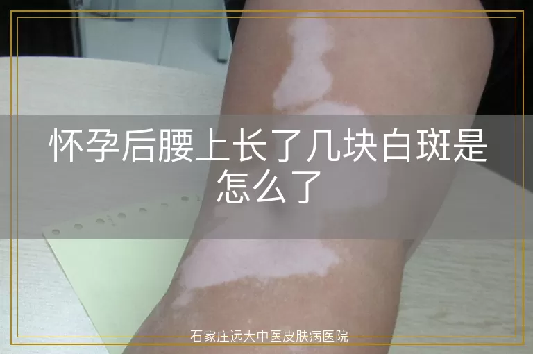 怀孕后腰上长了几块白斑是怎么了