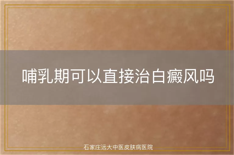 哺乳期可以直接治白癜风吗