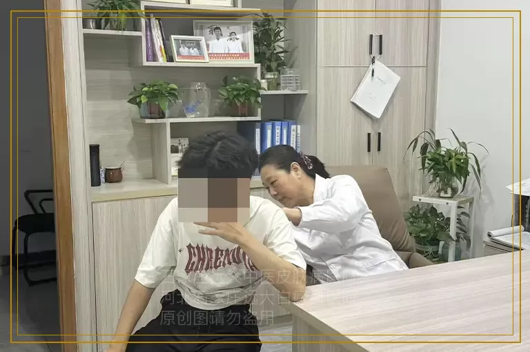 女性白癜风该用什么药物治疗
