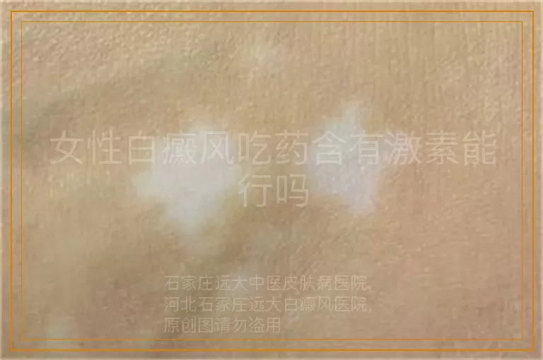 女性白癜风吃药含有激素能行吗