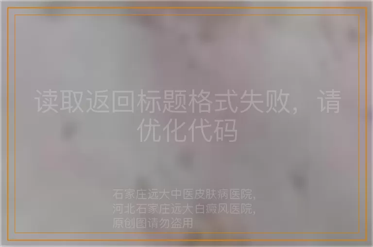 读取返回标题格式失败，请优化代码