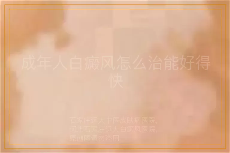 成年人白癜风怎么治能好得快