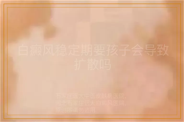 白癜风稳定期要孩子会导致扩散吗