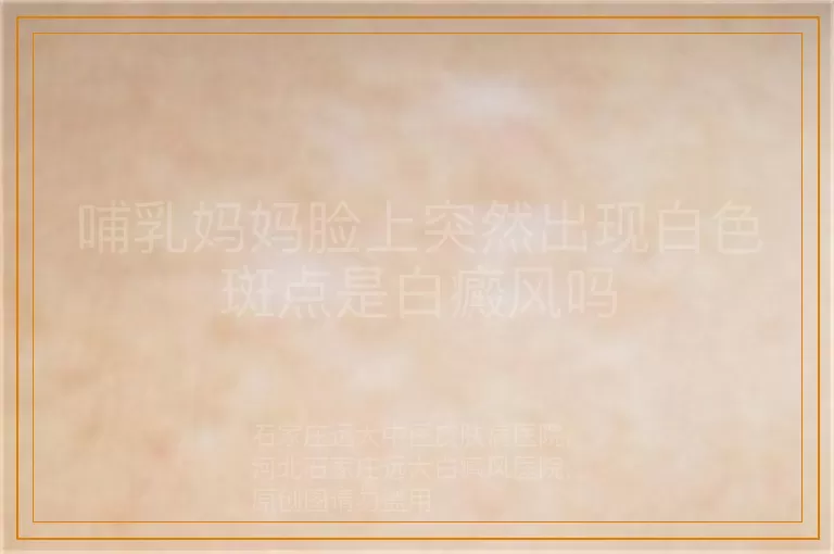 哺乳妈妈脸上突然出现白色斑点是白癜风吗