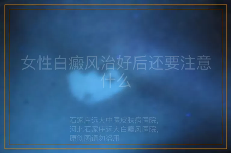 女性白癜风治好后还要注意什么