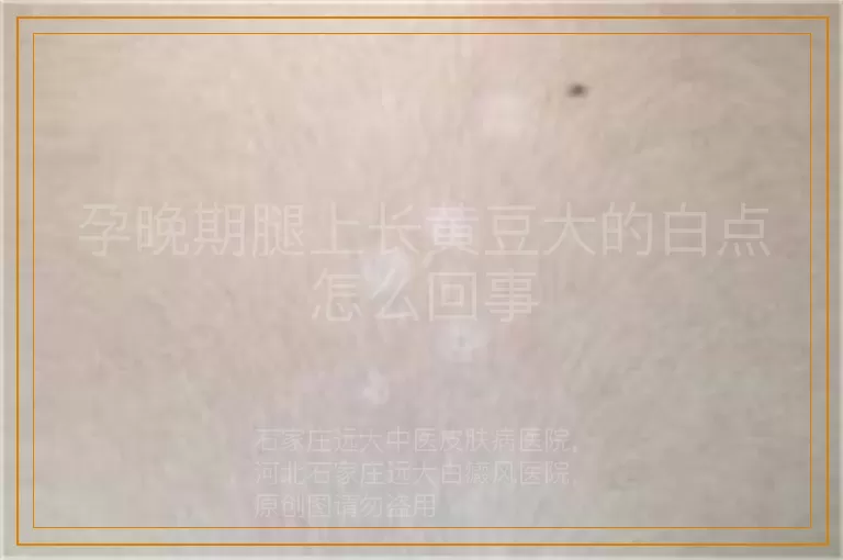 孕晚期腿上长黄豆大的白点怎么回事