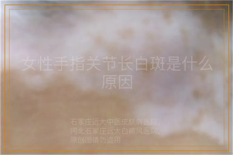 女性手指关节长白斑是什么原因