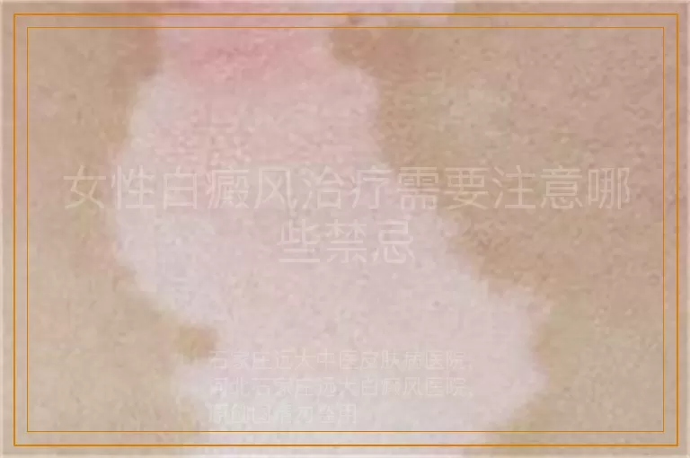 女性白癜风治疗需要注意哪些禁忌