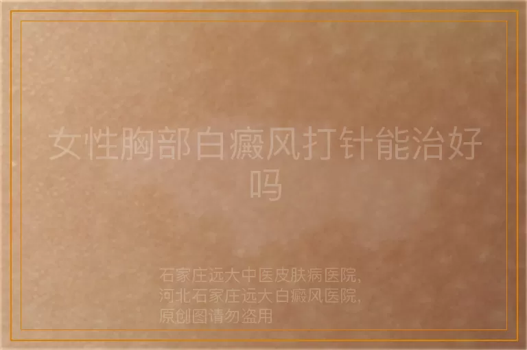 女性胸部白癜风打针能治好吗