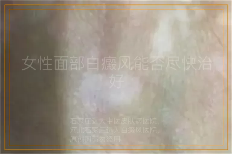 女性面部白癜风能否尽快治好