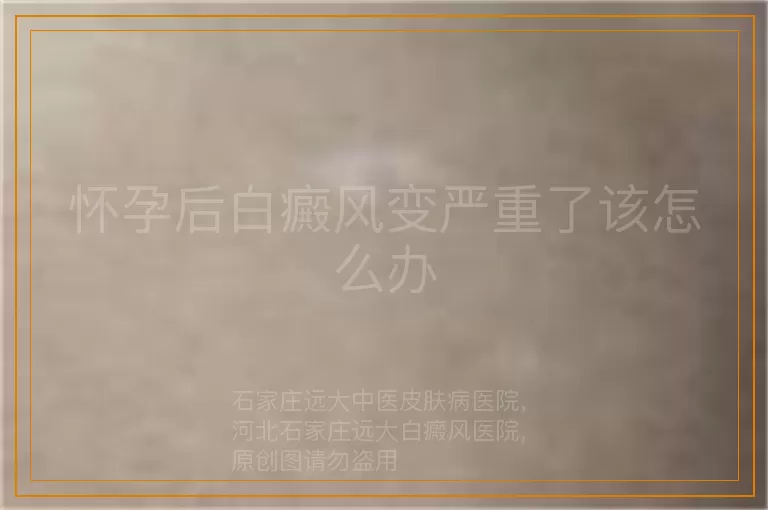 怀孕后白癜风变严重了该怎么办