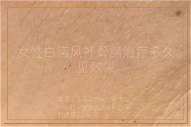 女性白癜风补骨脂治疗多久见效果