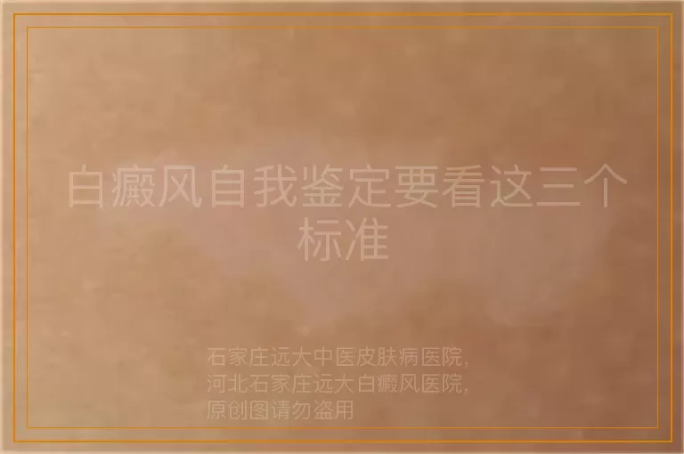 白癜风自我鉴定要看这三个标准