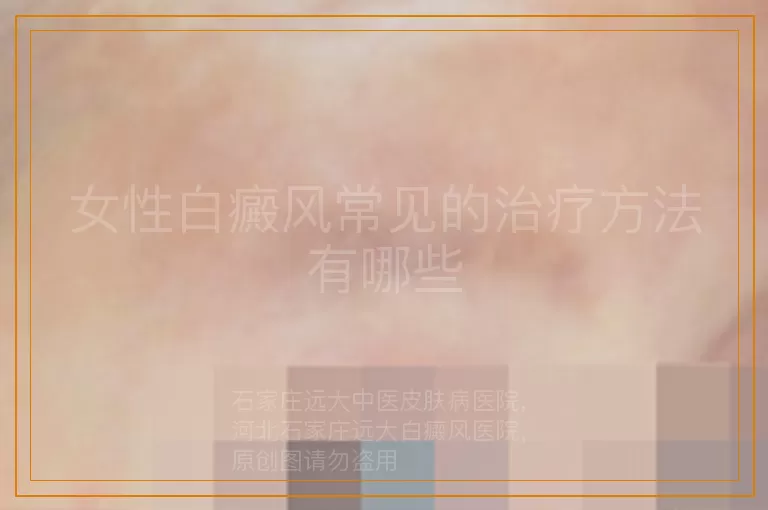 女性白癜风常见的治疗方法有哪些