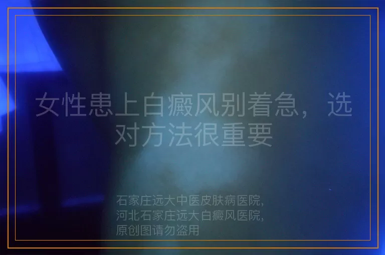 女性患上白癜风别着急，选对方法很重要