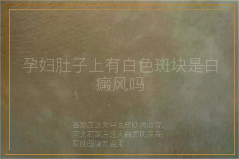孕妇肚子上有白色斑块是白癜风吗