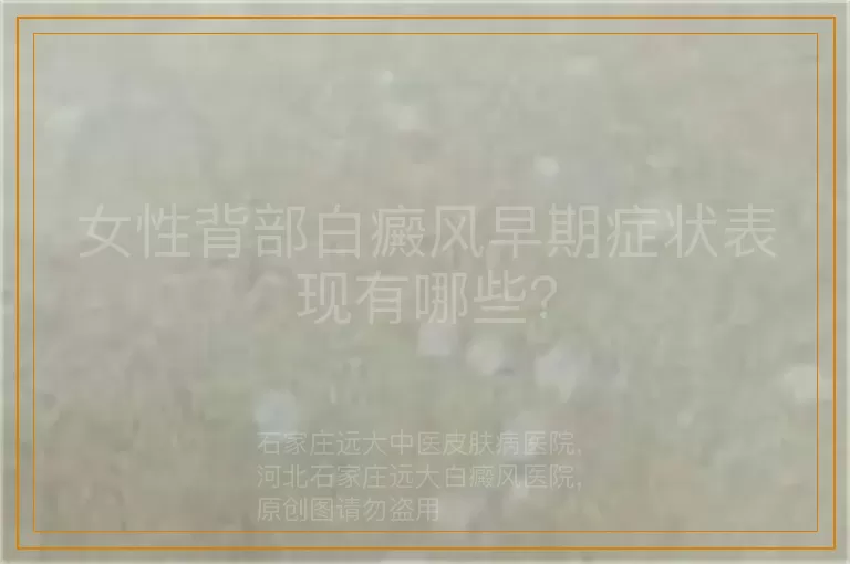女性背部白癜风早期症状表现有哪些？