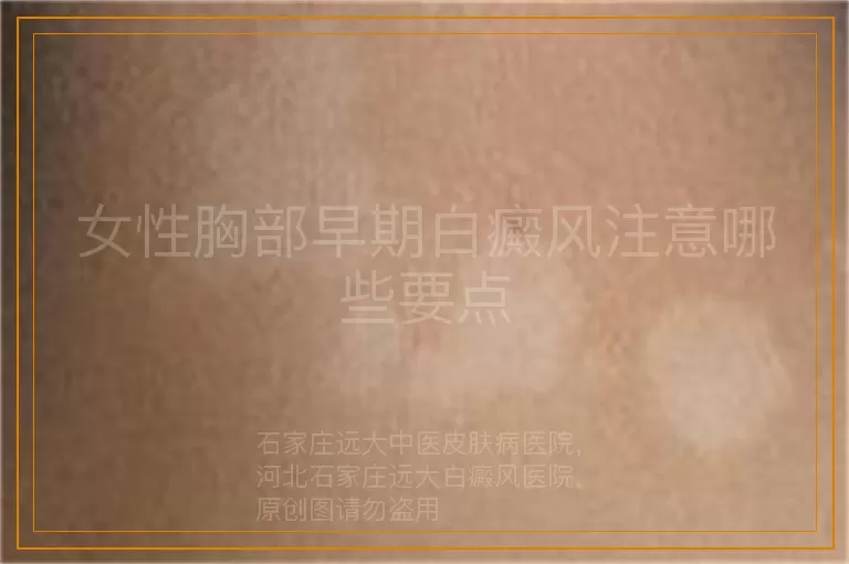 女性胸部早期白癜风注意哪些要点
