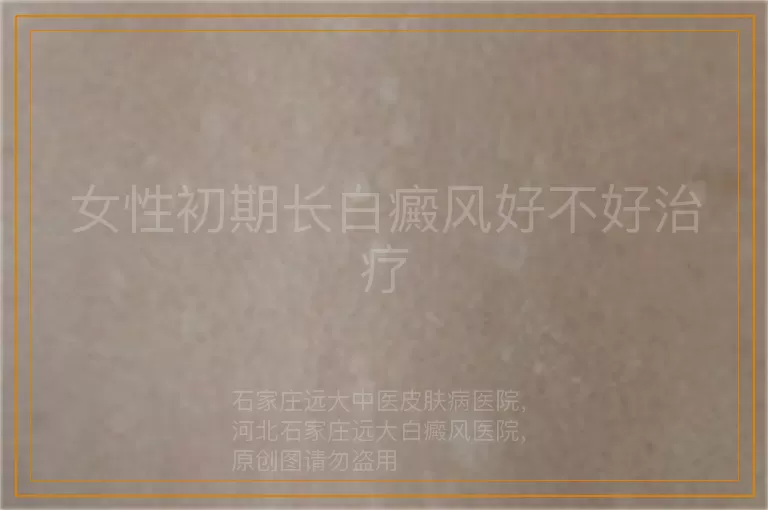 女性初期长白癜风好不好治疗