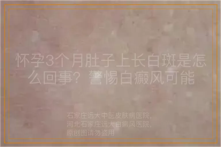 怀孕3个月肚子上长白斑是怎么回事？警惕白癜风可能