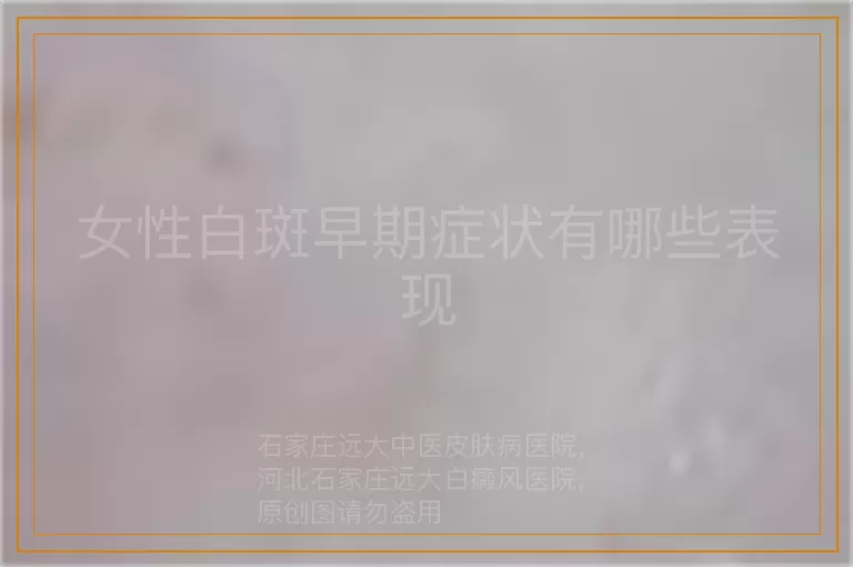 女性白斑早期症状有哪些表现