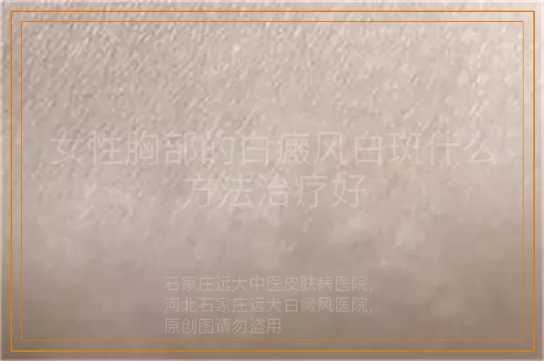 女性胸部的白癜风白斑什么方法治疗好