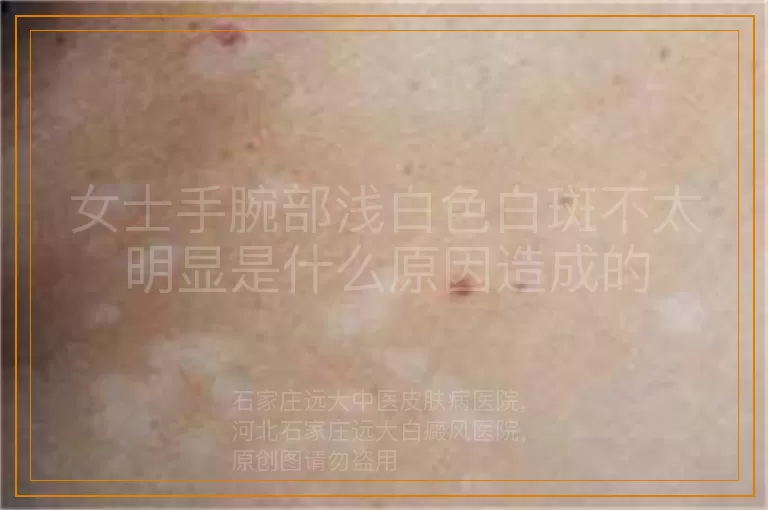女士手腕部浅白色白斑不太明显是什么原因造成的