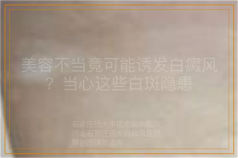 美容不当竟可能诱发白癜风？当心这些白斑隐患