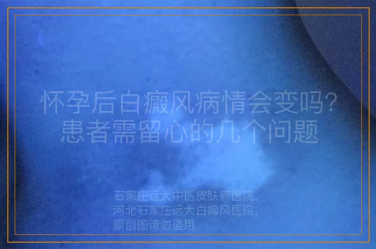 怀孕后白癜风病情会变吗？患者需留心的几个问题