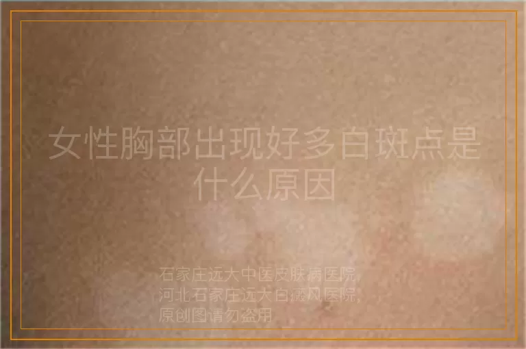 女性胸部出现好多白斑点是什么原因
