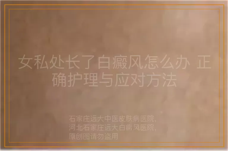 女私处长了白癜风怎么办 正确护理与应对方法