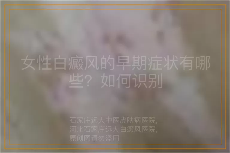 女性白癜风的早期症状有哪些？如何识别